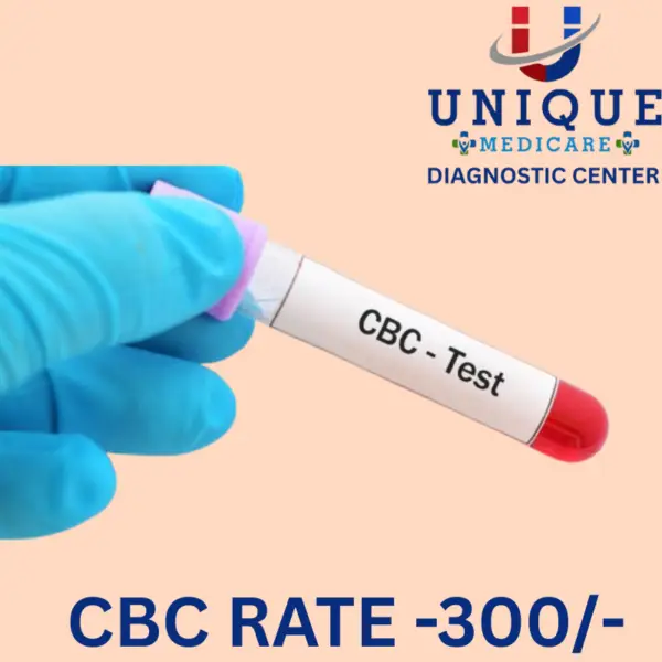 CBC TEST – UNIQUE MEDICARE DIAGNOSTIC CENTER