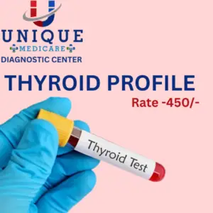 THYROID PROFILE