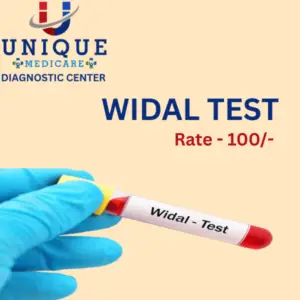 WIDAL TEST (Typhoid Test)