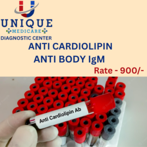 ANTI CARDIOLIPIN ANTI BODY IgM