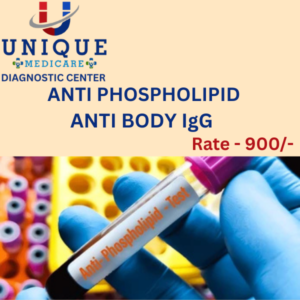 ANTI PHOSPHOLIPID ANTIBODY IgG