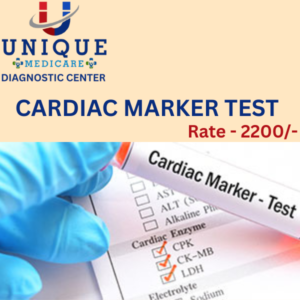 CARDIAC MARKER (LDH,CPK, CPKMB,HOMOCYSTEINE)