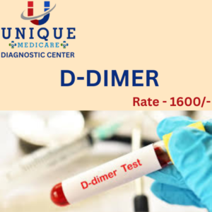 D-DIMER