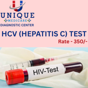 HCV (HEPATITIS C)