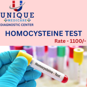 HOMOCYSTEINE (SERUM)