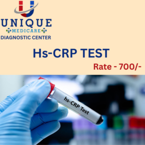 Hs-CRP TEST