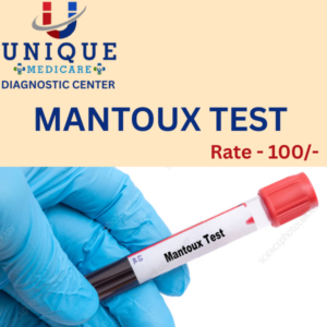 MANTOUX TEST