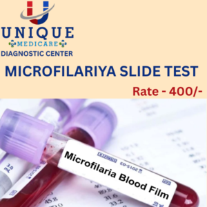 MICROFILARIYA SLIDE TEST