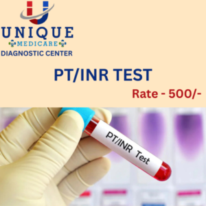 PT / INR TEST