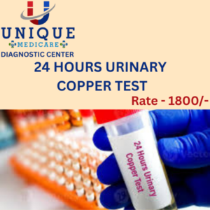 24 HOURS COPPER URINE