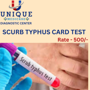 SCURB TYPHUS CARD TEST