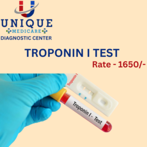 TROPONIN I