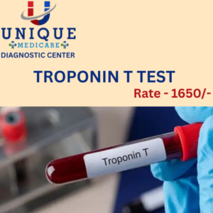 TROPONIN T