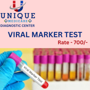 VIRAL MARKER (HIV, HBSAg, HCV)