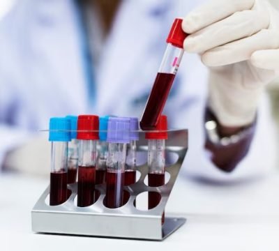 imgi_84_doctor-checking-blood-samples_53876-71644